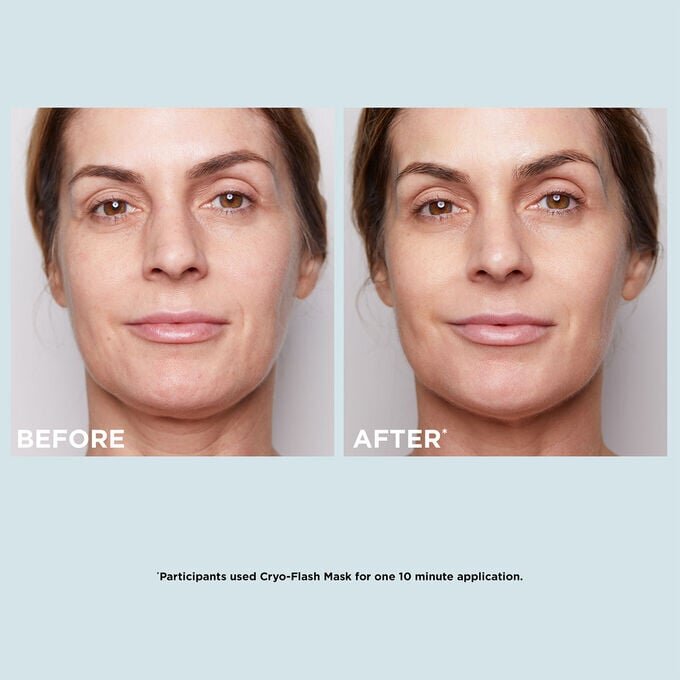 Dúo de mascarillas superventas | Con la mascarilla Cryo-Flash y la mascarilla V-Intensive Wrap | Mascarillas faciales galardonadas del rostro