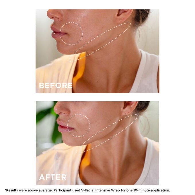Dúo de mascarillas superventas | Con la mascarilla Cryo-Flash y la mascarilla V-Intensive Wrap | Mascarillas faciales galardonadas del rostro