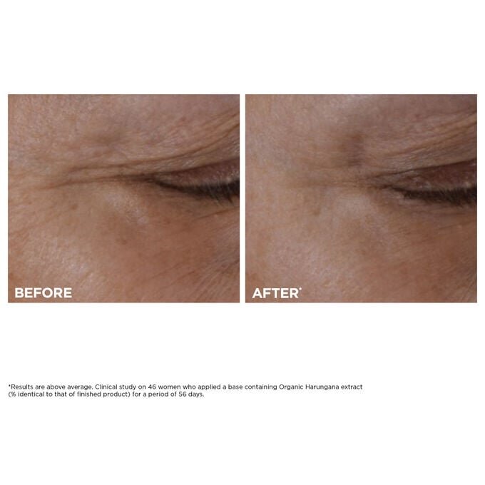 Double Serum + NUEVO Total Eye Lift Duo | Rutina antienvejecimiento más vendida | Con el NUEVO Total Eye Lift, para un lifting ocular visible en 30 segundos