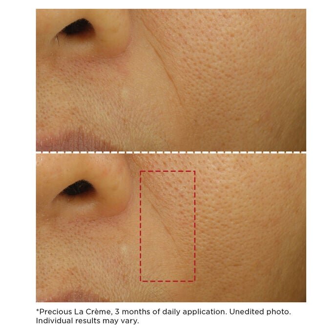 Dúo exclusivo | Cremas antienvejecimiento de lujo para el rostro y el contorno de los ojos | Actúa sobre las arrugas, la hinchazón y las ojeras