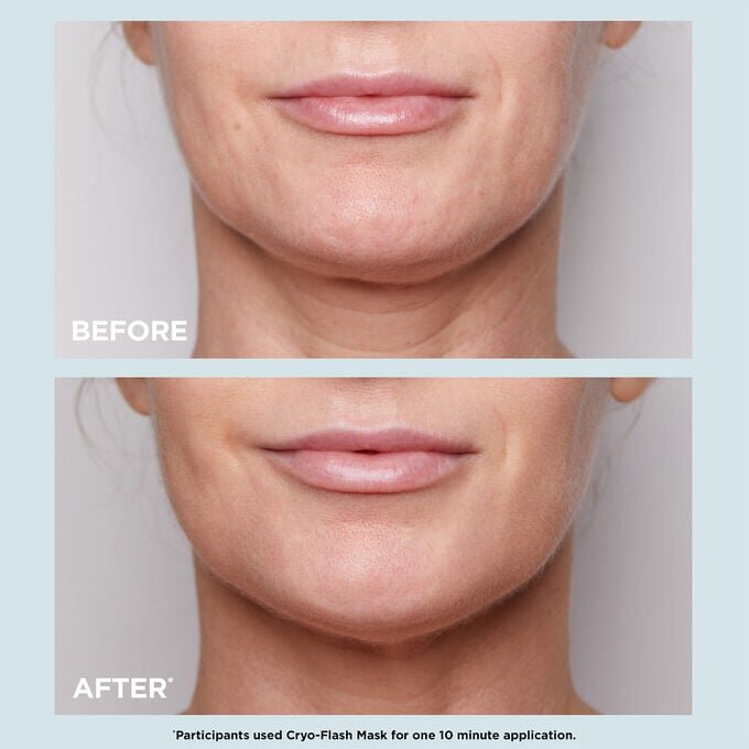 Mascarilla Cryo-Flash: mascarilla facial en gel-crema que refina los poros y reafirma el rostro