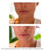 Mascarilla facial desinflamante V-Facial Intensive Wrap
