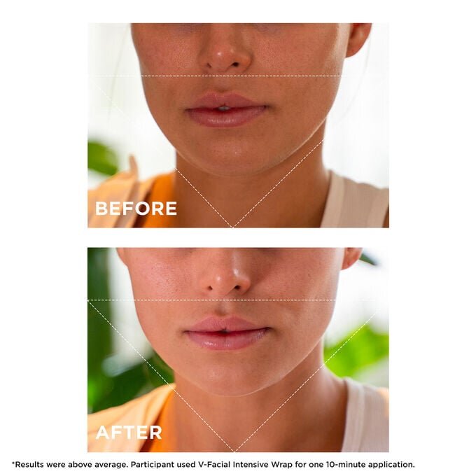 Mascarilla facial desinflamante V-Facial Intensive Wrap